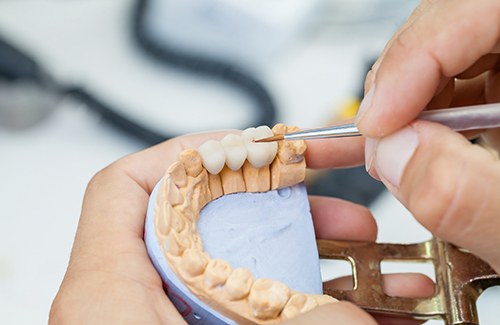 A technician working on a dental bridge