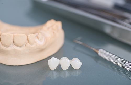 A dental bridge sitting next to various dental tools