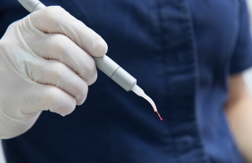 Dentist holding a thin gray laser pen
