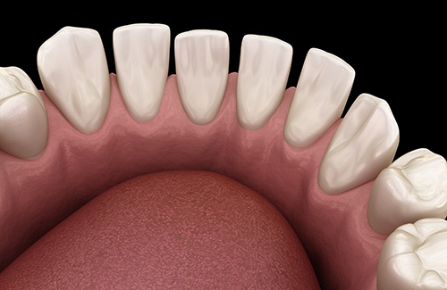 Patient in Grantsville with tooth gaps