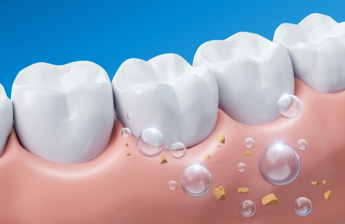 Illustrated bubbles next to row of teeth