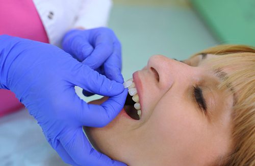 Patient in Grantsville getting veneers