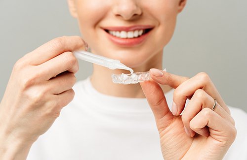 Woman applying bleaching gel to custom-fitted applicator tray